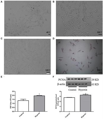 Pulmonary Artery Smooth Muscle Cell Senescence Promotes the Proliferation of PASMCs by Paracrine IL-6 in Hypoxia-Induced Pulmonary Hypertension